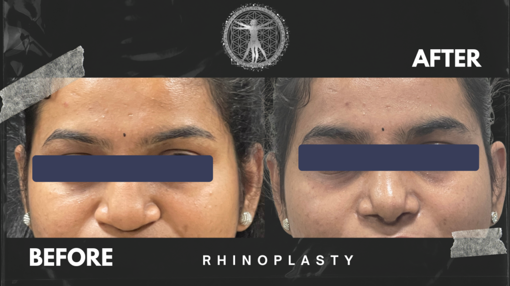 23 - Dr.Rajesh Vasu, - Dr.Rajesh Vasu,