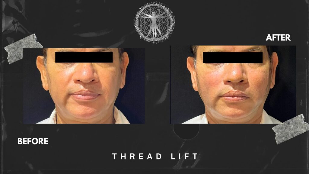 70 - Dr.Rajesh Vasu, - Dr.Rajesh Vasu,